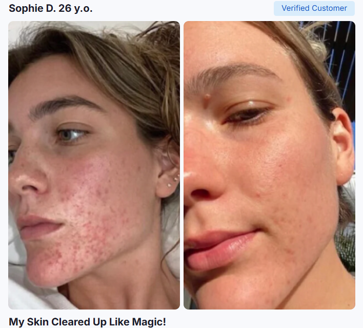 Clarexin result – customer before and after parasite cleanse